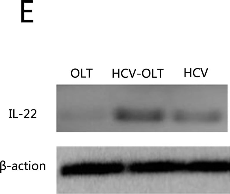 Detection of Human IL-22 by Western Blot