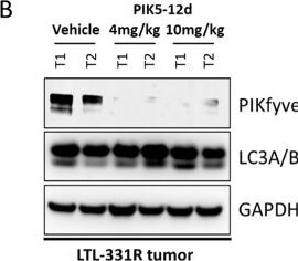 Detection of PIKFyve by Western Blot