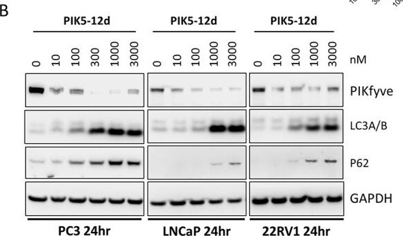 Detection of PIKFyve by Western Blot