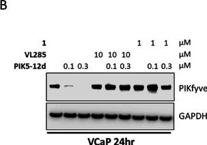 Detection of PIKFyve by Western Blot