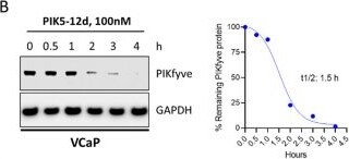 Detection of PIKFyve by Western Blot