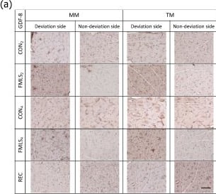 Detection of GDF-8/Myostatin by Immunohistochemistry