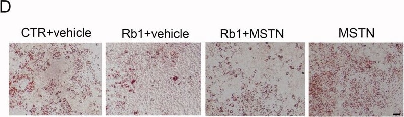 Detection of GDF-8/Myostatin by Immunohistochemistry
