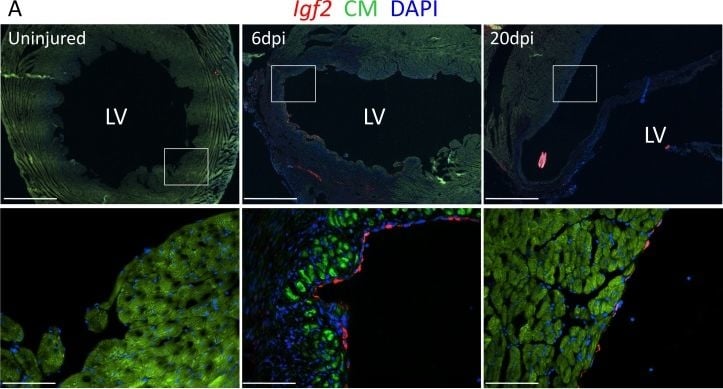 Detection of IGF-II/IGF2 by Immunohistochemistry