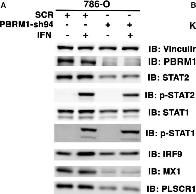 Detection of MxA/Mx1 by Western Blot