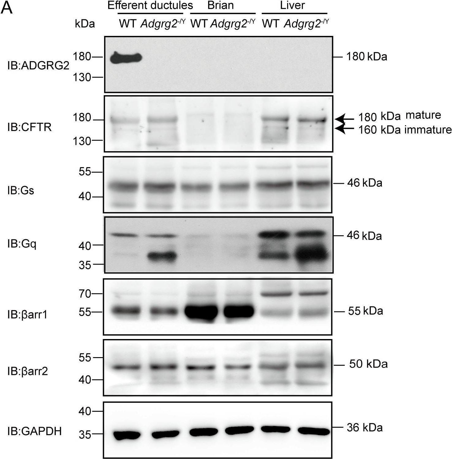 Detection of GPR64 by Western Blot