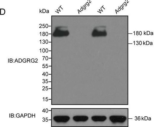Detection of GPR64 by Western Blot