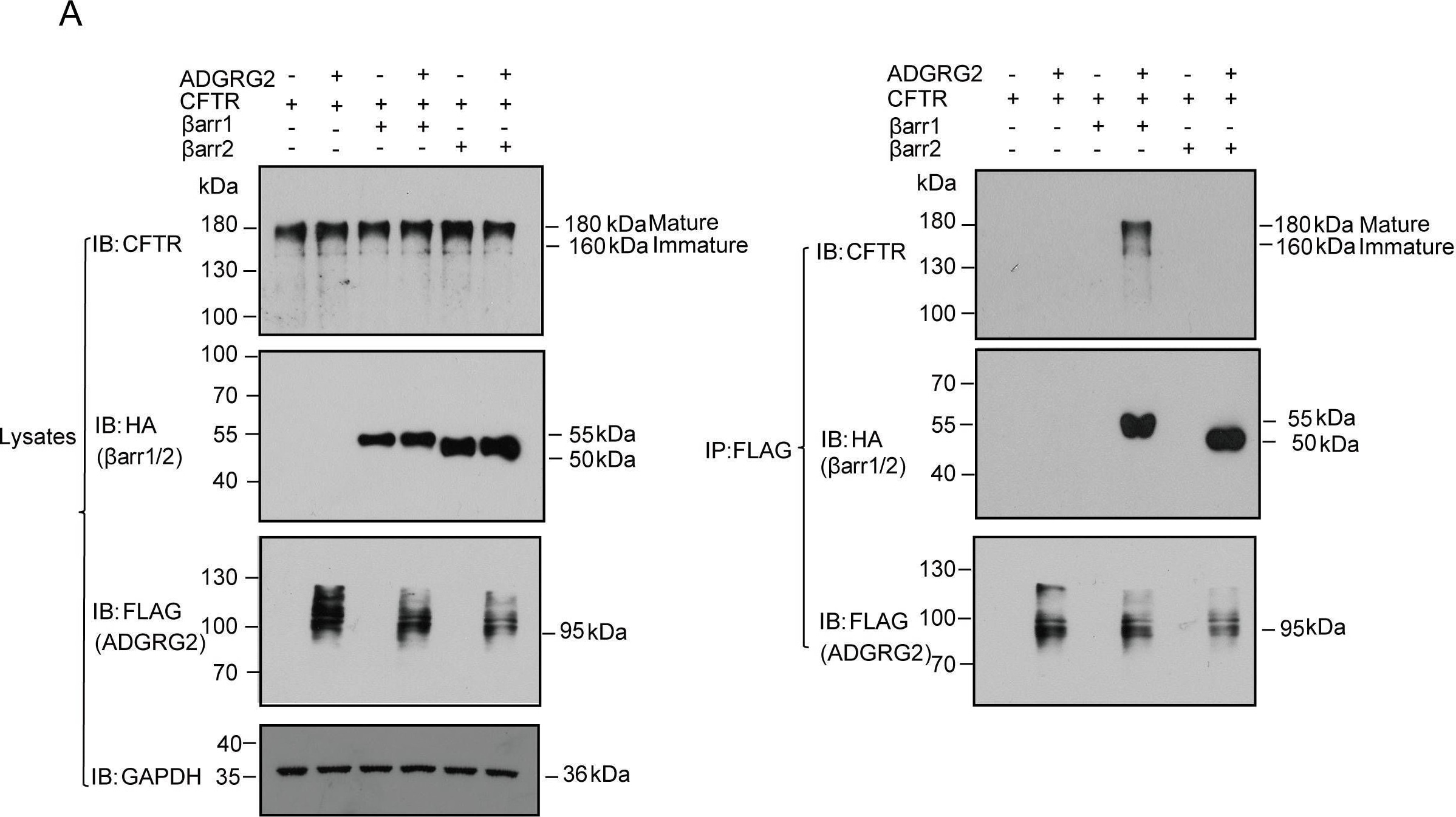 Detection of GPR64 by Western Blot