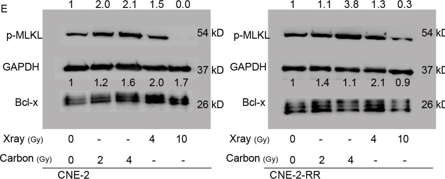 Detection of Bcl-x by Western Blot