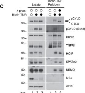 Detection of HOIP/RNF31 by Western Blot