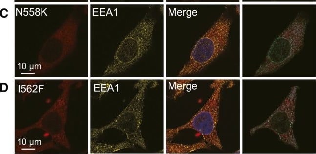 Detection of EEA1 by Immunocytochemistry/ Immunofluorescence