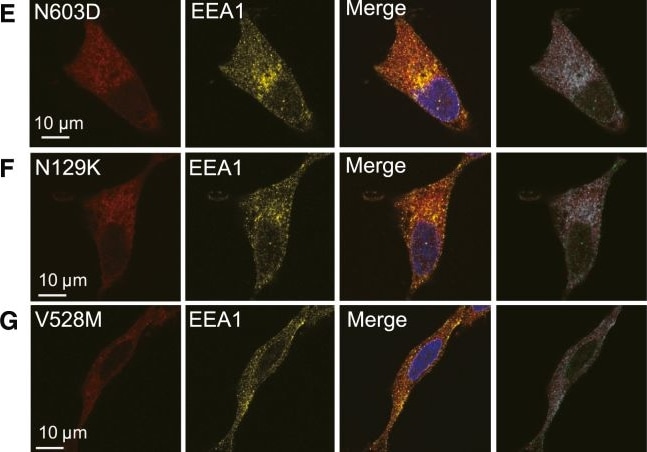 Detection of EEA1 by Immunocytochemistry/ Immunofluorescence