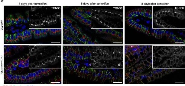 Detection of TGN38 by Immunohistochemistry