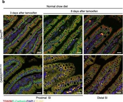 Detection of TGN38 by Immunohistochemistry