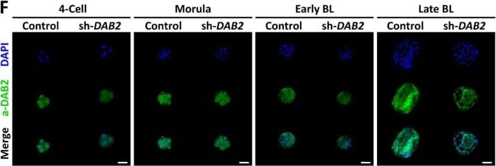 Detection of DAB2 by Immunocytochemistry/ Immunofluorescence