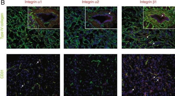 Detection of Human CD31/PECAM-1 by Immunocytochemistry/Immunofluorescence