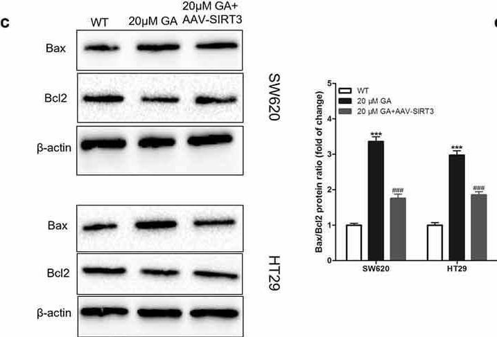 Detection of Bcl-2 by Western Blot