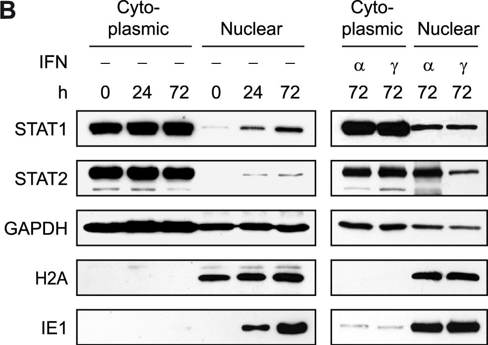 Detection of IFN-beta by Western Blot