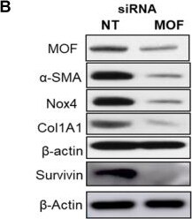 Detection of Nox4 by Western Blot