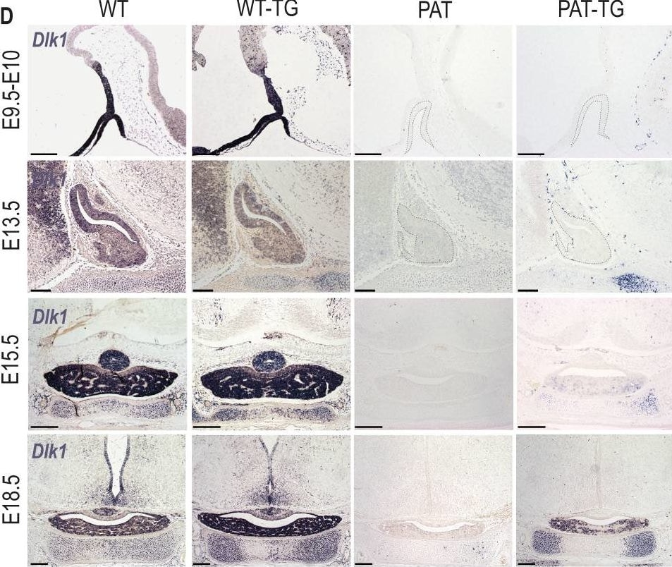Detection of Mouse Pref-1/DLK1/FA1 by Immunohistochemistry
