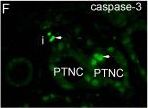 Detection of Human Human/Mouse Active Caspase-3 Antibody by Immunohistochemistry