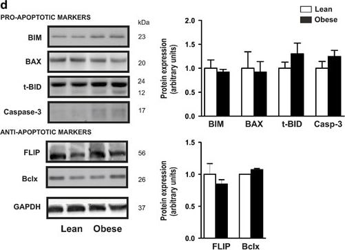 Detection of Human BID by Western Blot