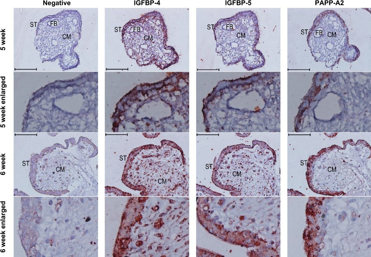 Detection of Human IGFBP-5 by Immunohistochemistry