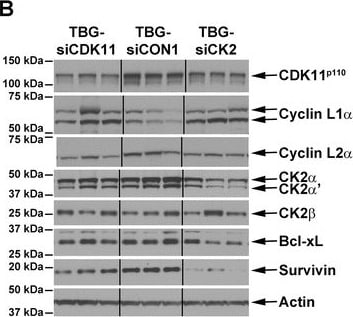 Detection of Human Survivin by Western Blot