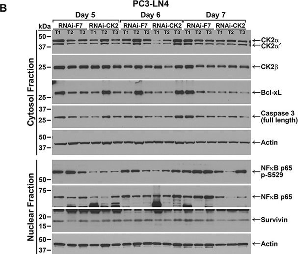 Detection of Human Survivin by Western Blot