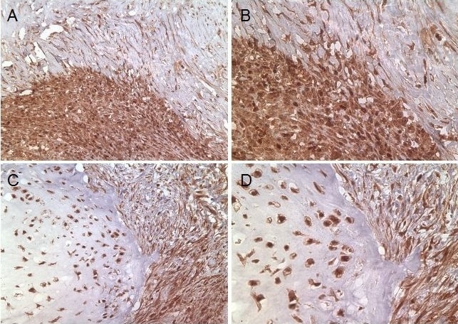 Detection of Human Survivin by Immunohistochemistry