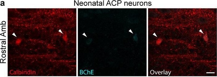 Detection of Butyrylcholinesterase/BCHE by Immunohistochemistry
