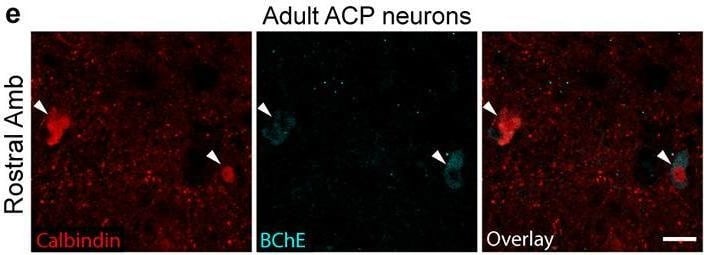 Detection of Butyrylcholinesterase/BCHE by Immunohistochemistry