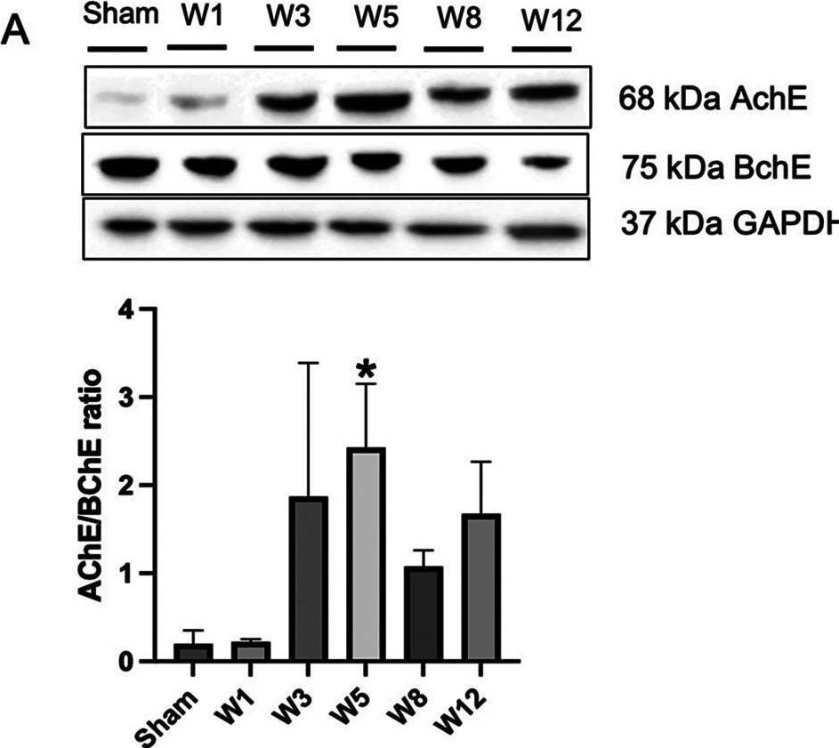 Detection of Butyrylcholinesterase/BCHE by Western Blot