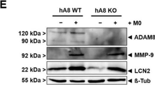 Detection of Human MMP-9 by Western Blot