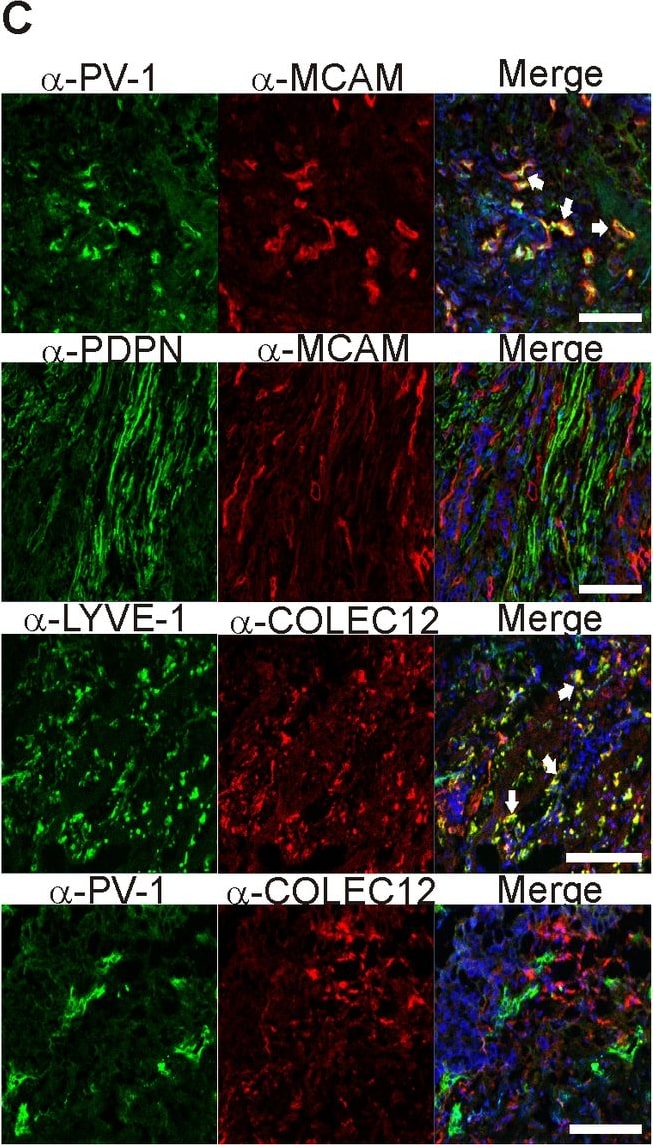 Detection of Human MCAM/CD146 by Immunocytochemistry/ Immunofluorescence