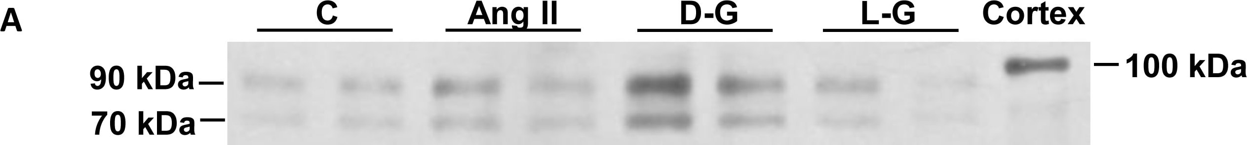 Detection of Mouse ACE-2 by Western Blot