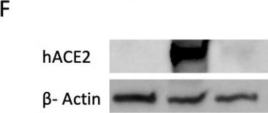 Detection of Human ACE-2 by Western Blot