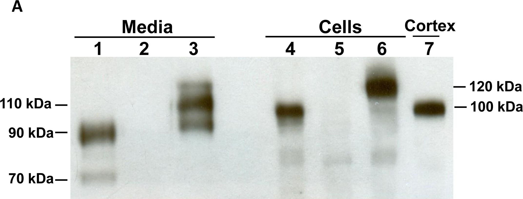 Detection of Mouse ACE-2 by Western Blot