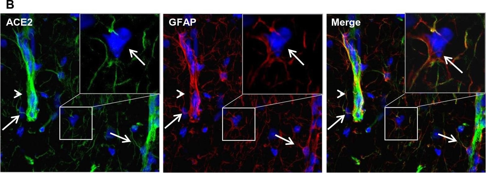 Detection of Mouse ACE-2 by Immunohistochemistry