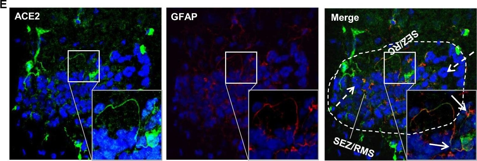 Detection of Mouse ACE-2 by Immunohistochemistry