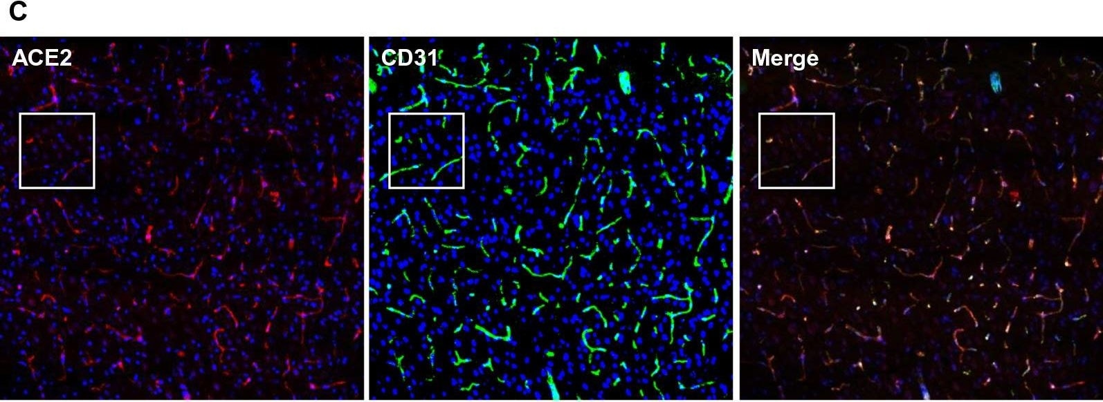 Detection of Mouse ACE-2 by Immunohistochemistry