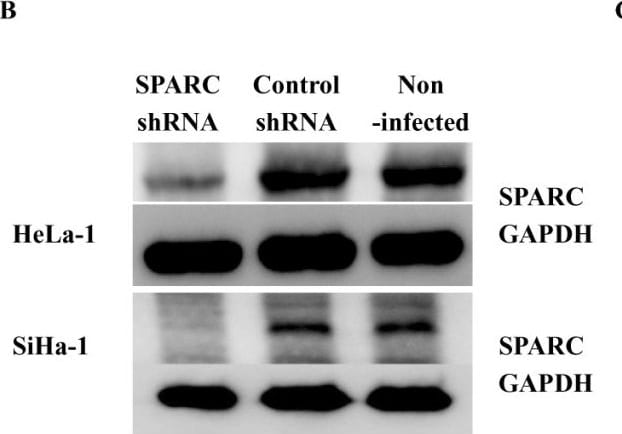 Detection of Human SPARC by Western Blot