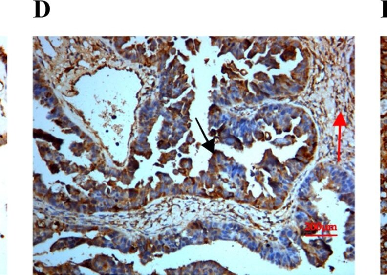 Detection of Human SPARC by Immunocytochemistry/ Immunofluorescence