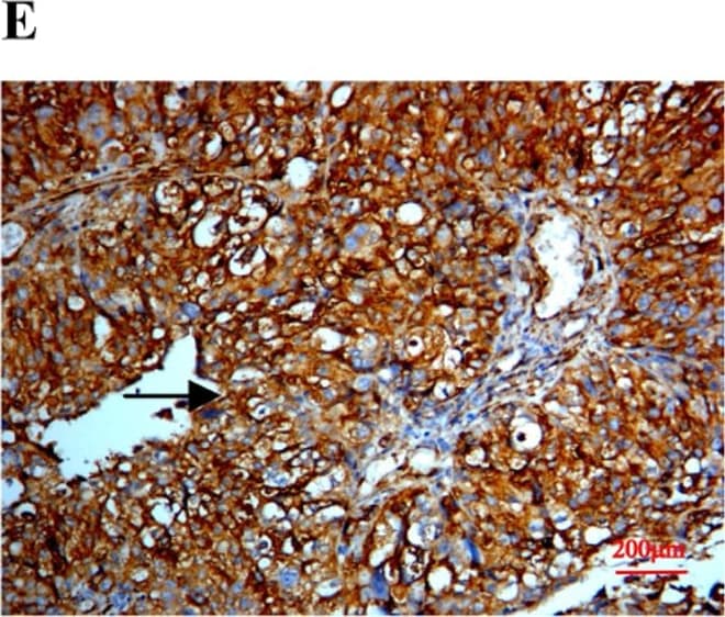 Detection of Human SPARC by Immunocytochemistry/ Immunofluorescence