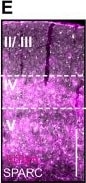 Detection of SPARC by Immunohistochemistry