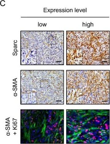 Detection of SPARC by Immunohistochemistry