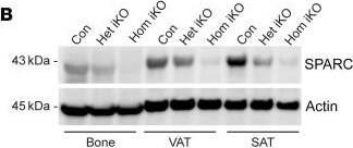 Detection of SPARC by Western Blot