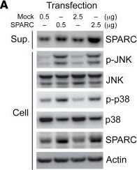 Detection of SPARC by Western Blot
