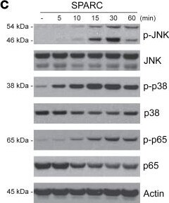Detection of SPARC by Western Blot