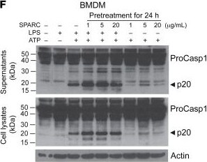 Detection of SPARC by Western Blot